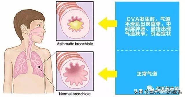 三个月大的宝宝咳嗽怎么办？全面解析宝宝咳嗽原因与应对之策